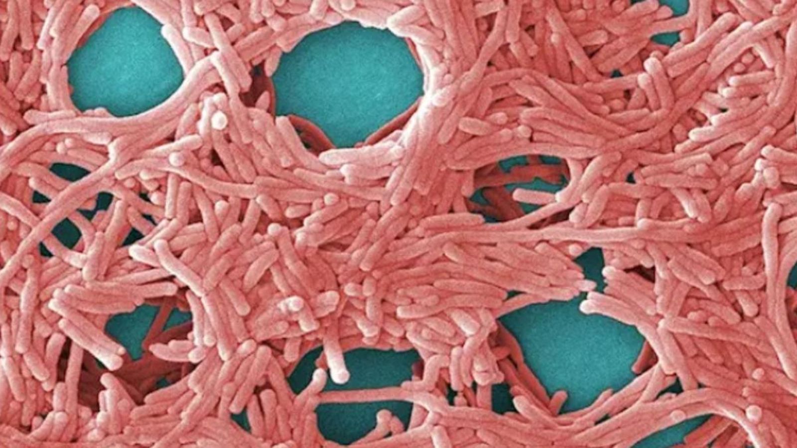 Bacteri de la legionel·la