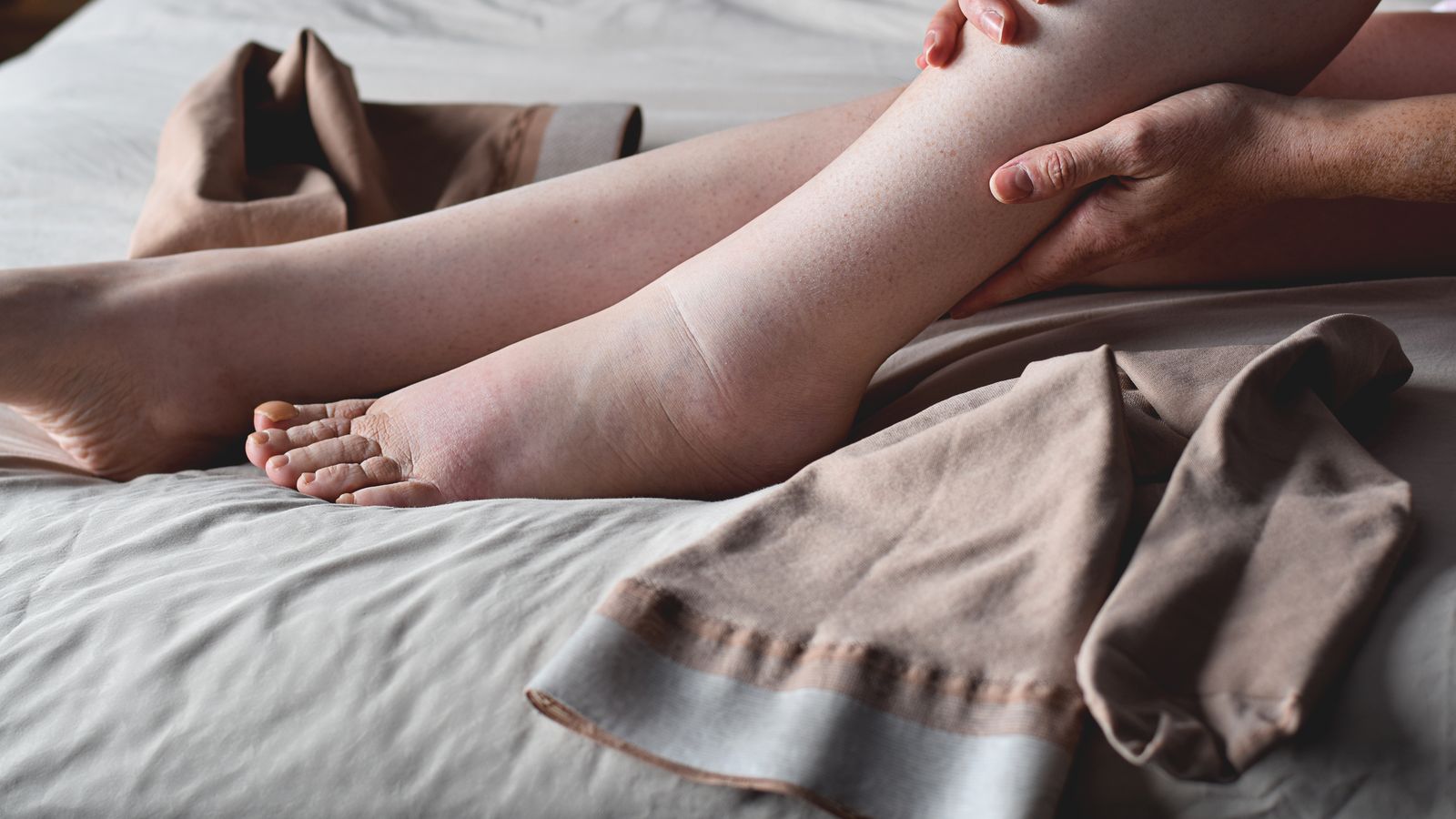 Una persona amb els peus i els turmells unflats