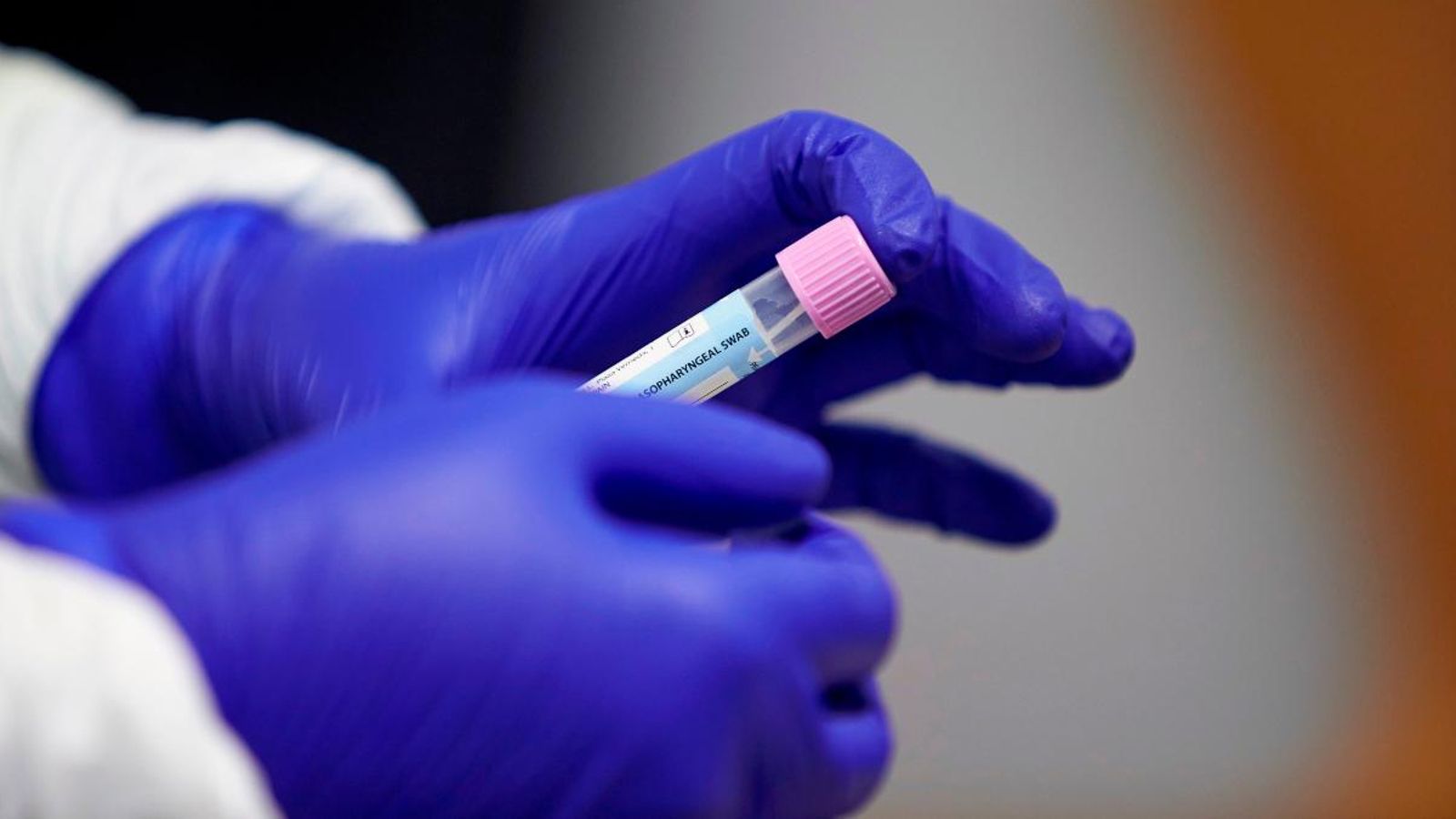 Una prova PCR recollida per a analitzar