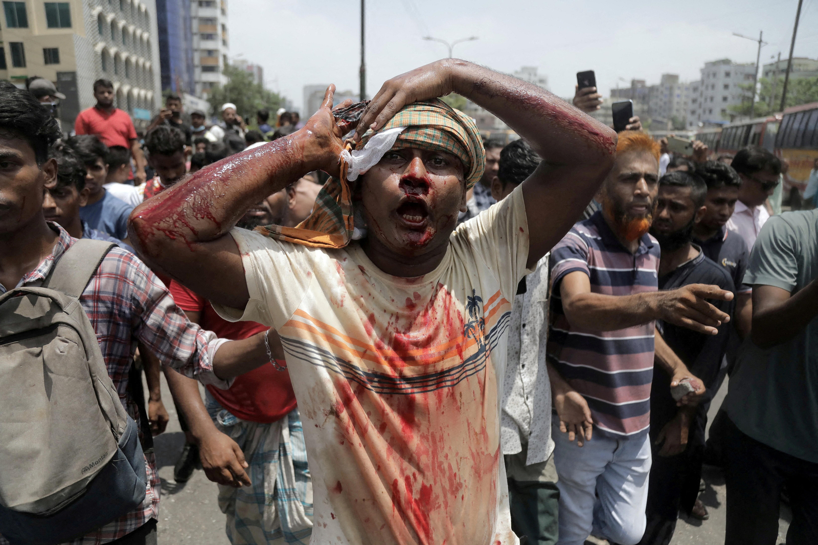 Un dels manifestants ferits en les protestes a Dhaka
