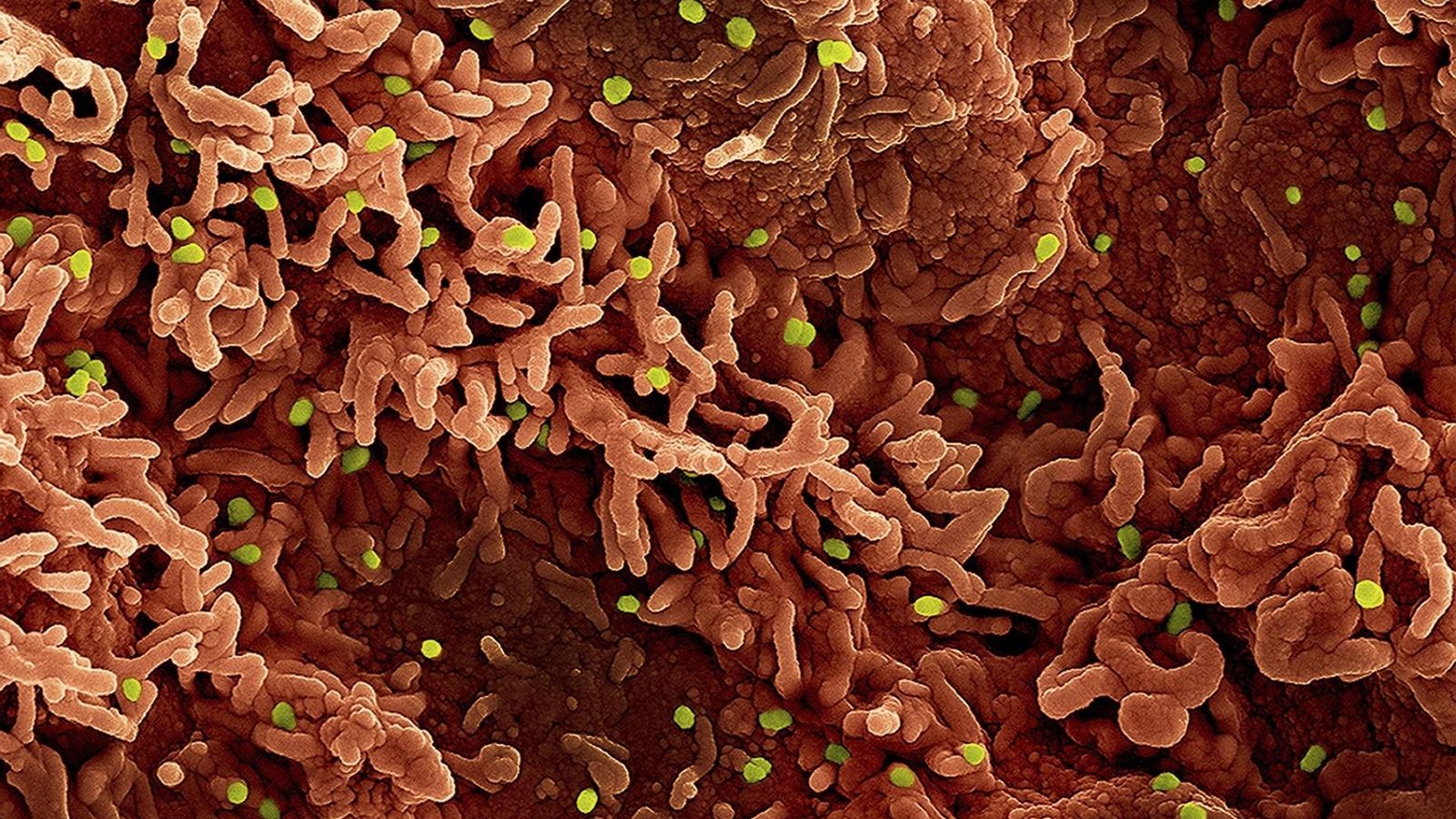 Partícules del virus del mpox vistes a través d'un microscopi elèctric