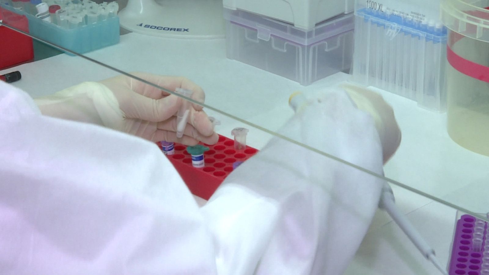 Un home, de 34 anys, que presenta símptomes compatibles amb la malaltia, va estar a Guinea Equatorial