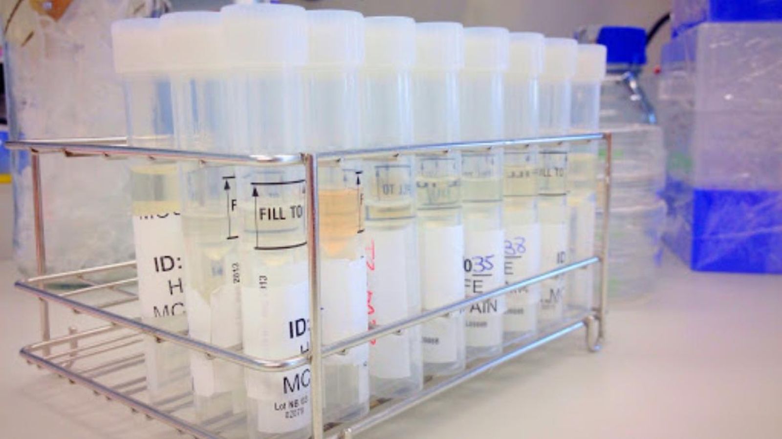 Vacunes en imatge d'arxiu