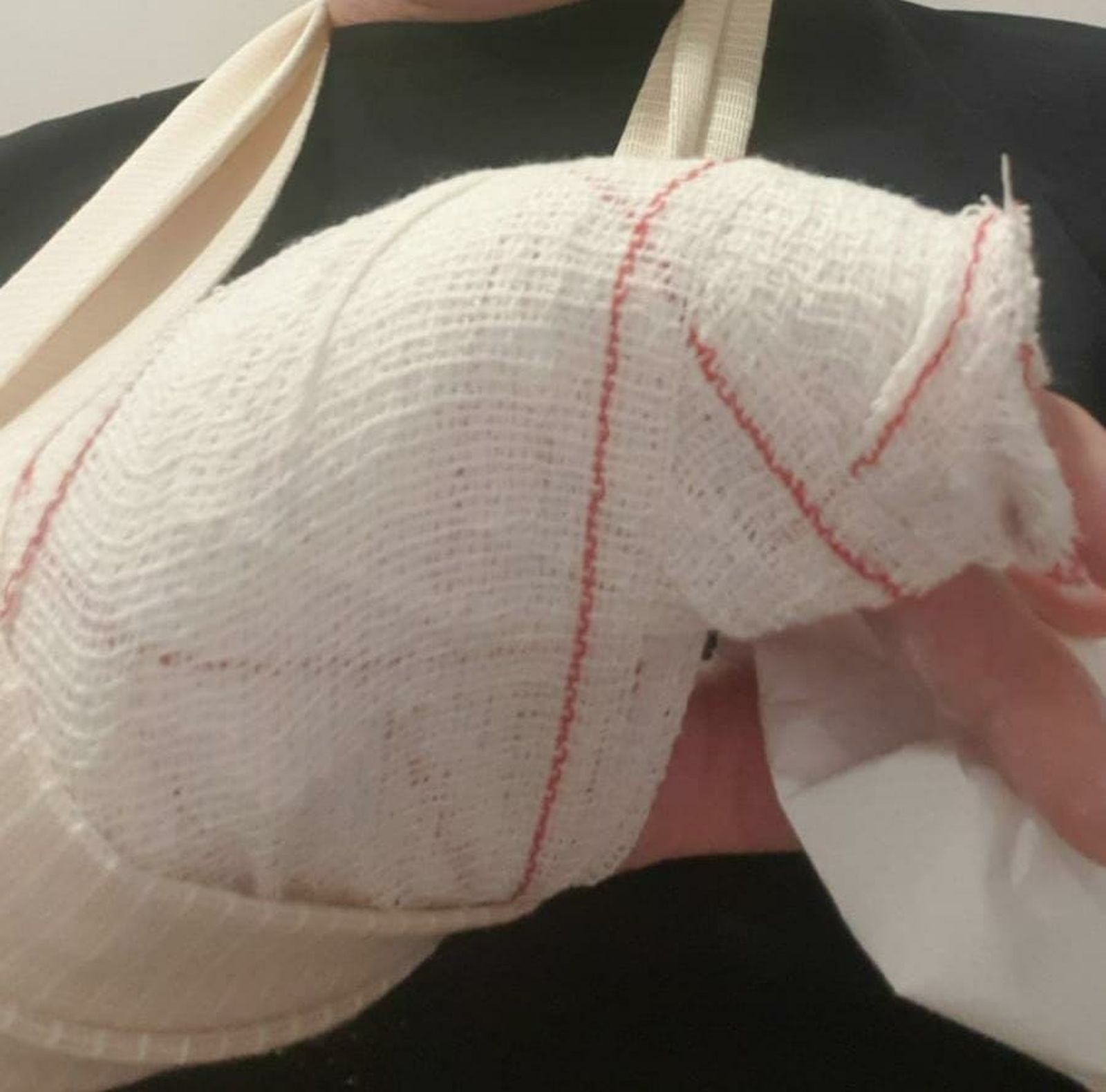 Imatge del funcionari amb el dit trencat