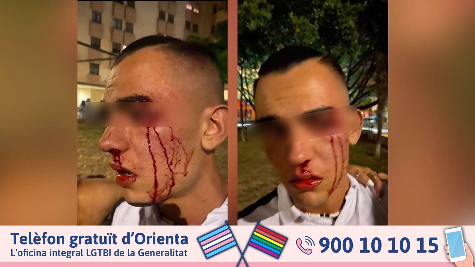 Rostre del jove agredit la passada nit de Sant Joan a València per la seua condició sexual