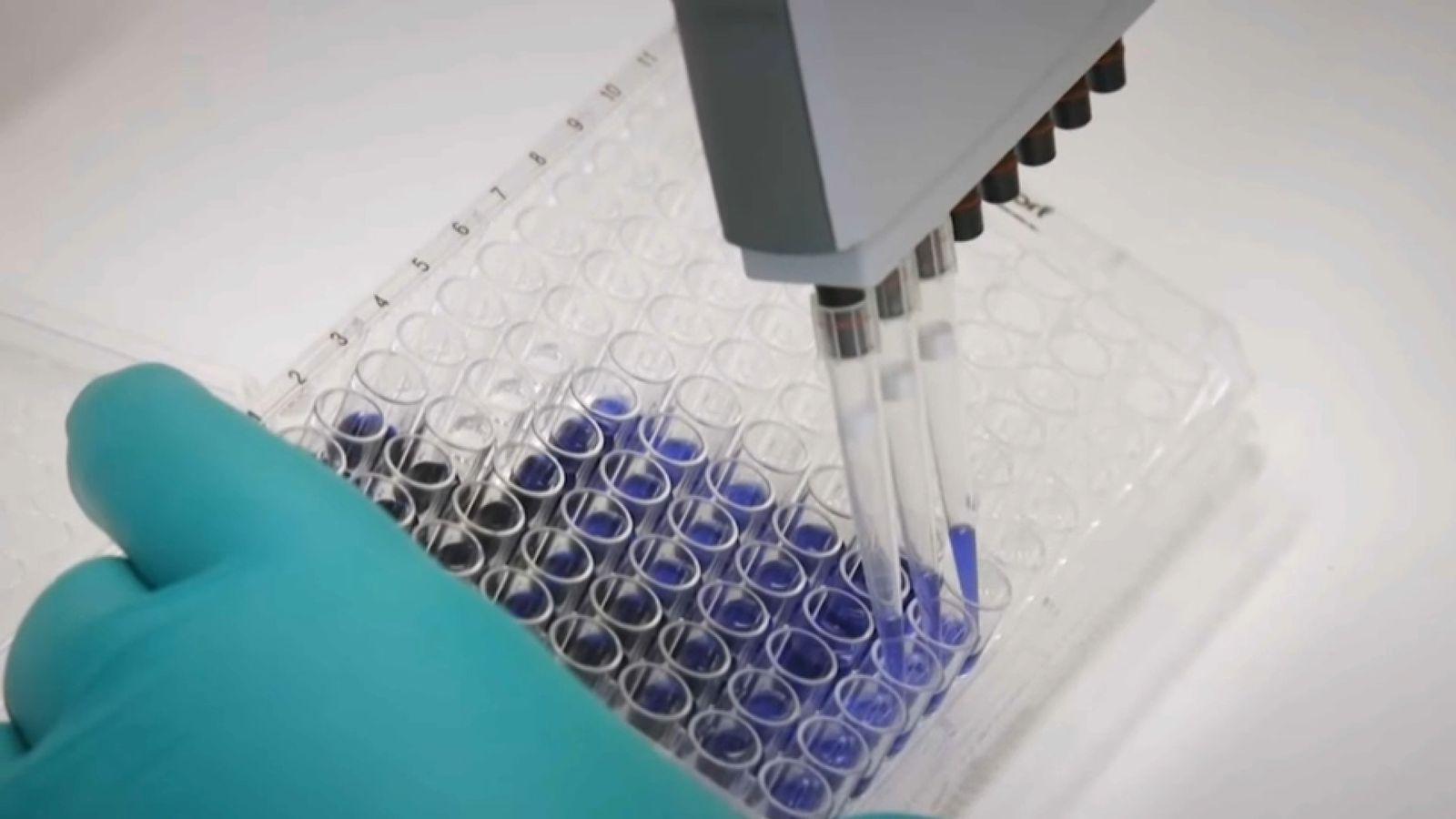 Personal sanitari desenvolupa treballs d'anàlisi de les mostres