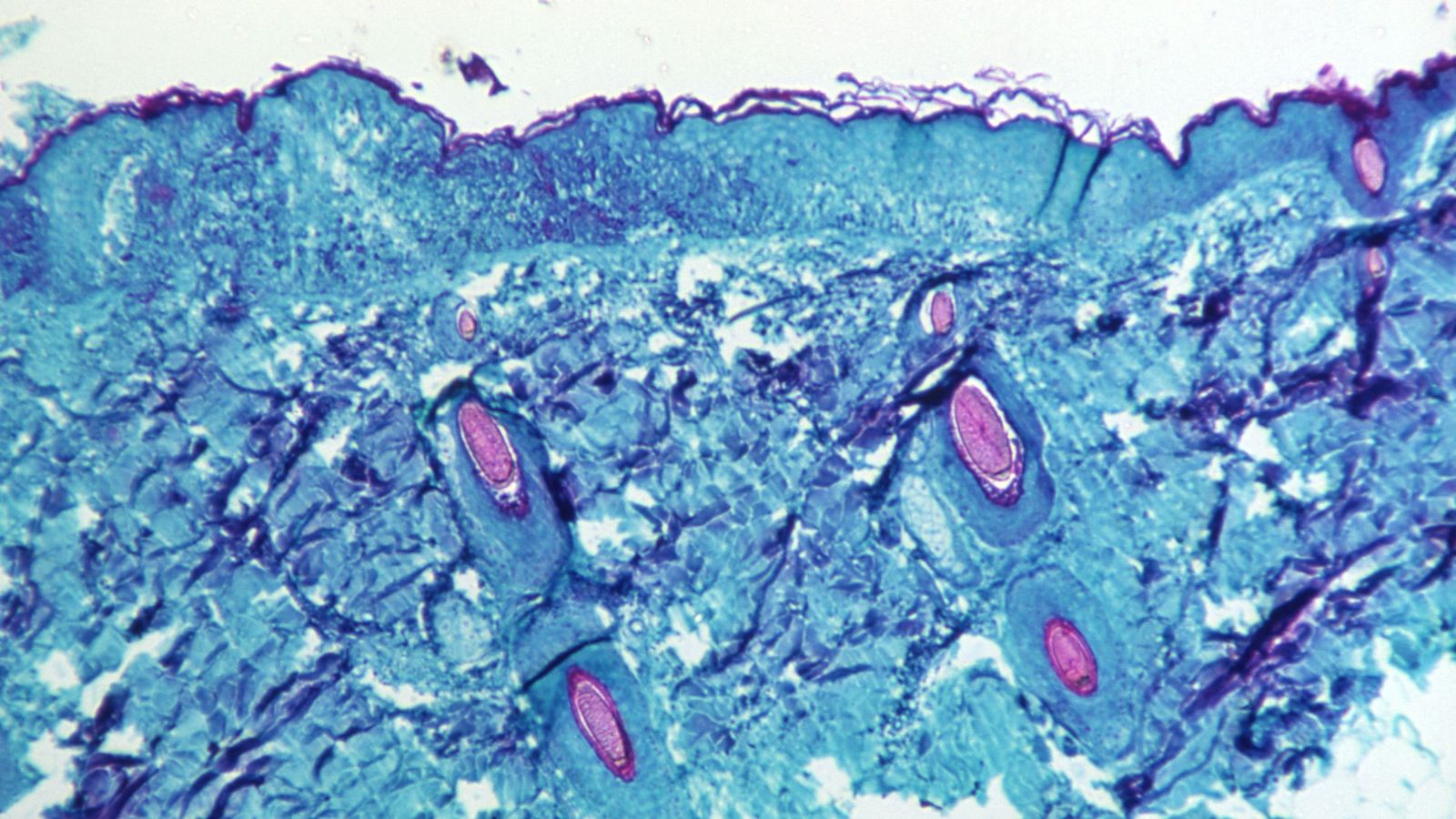 Secció de teixit cutani d'un mico infectat pel virus