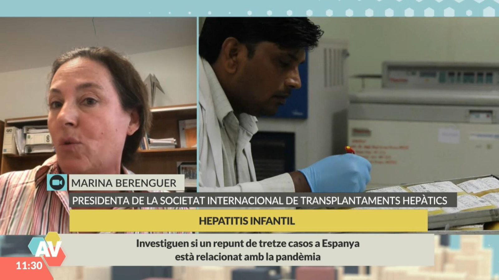 Hepatitis infantil