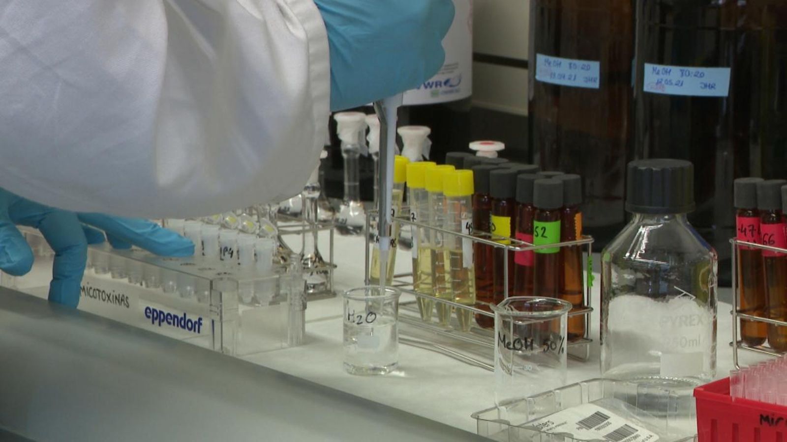 Una anàlisi d'orina podria servir per a detectar l'Alzheimer en fase inicial