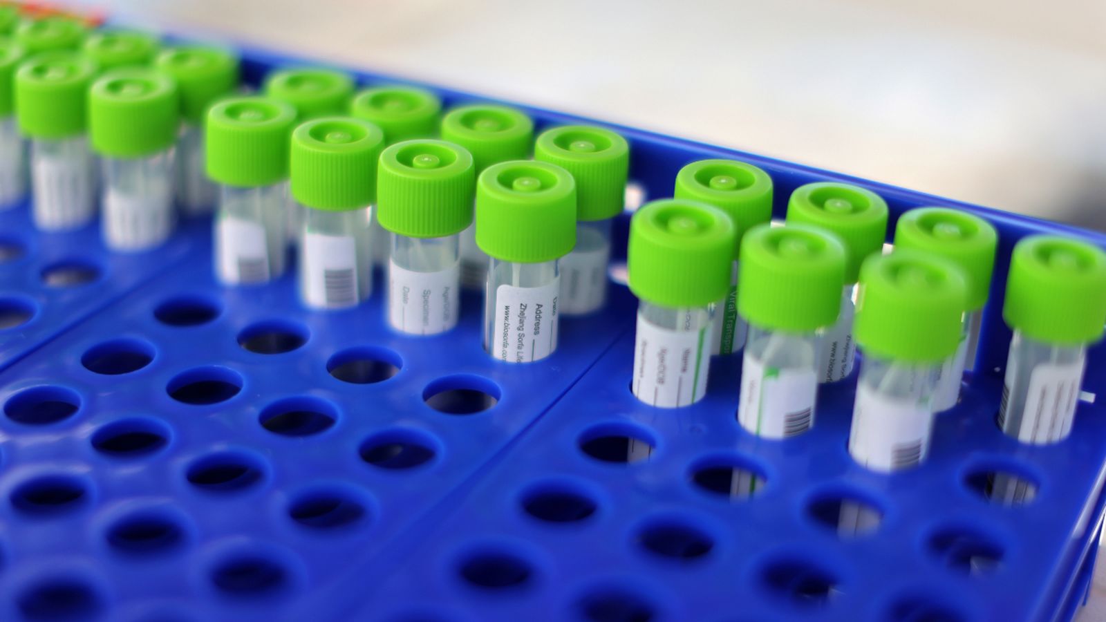 Mostres de coronavirus analitzades en un laboratori