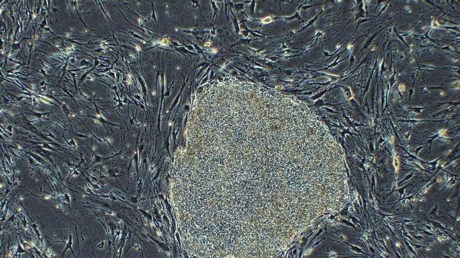 Cèl·lules iPS a vista microscòpica