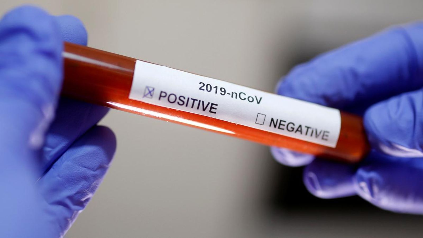 Tub d'assaig per a detectar el coronavirus
