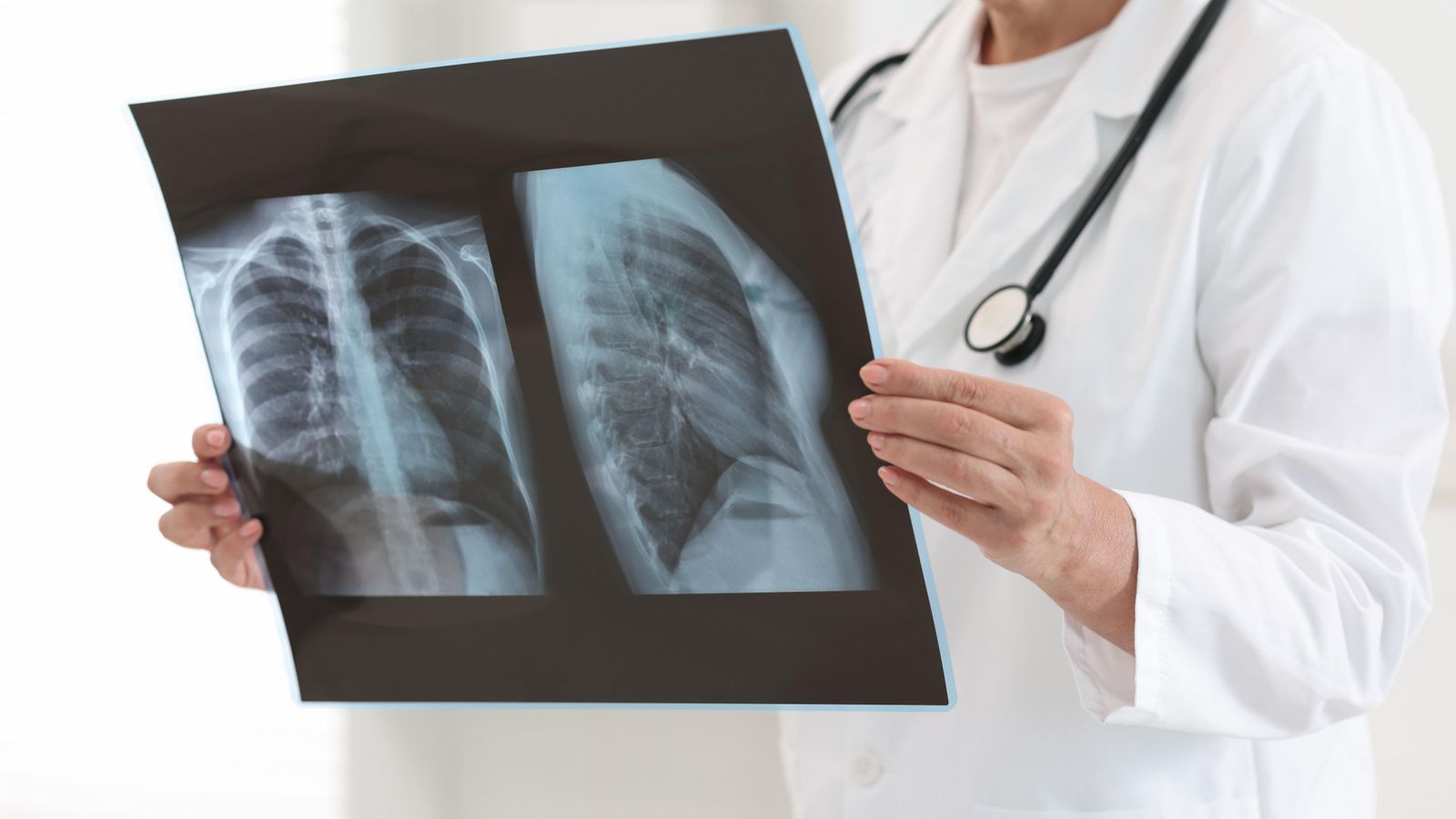 Una metgessa examina una radiografia Una metgessa examina una radiografia