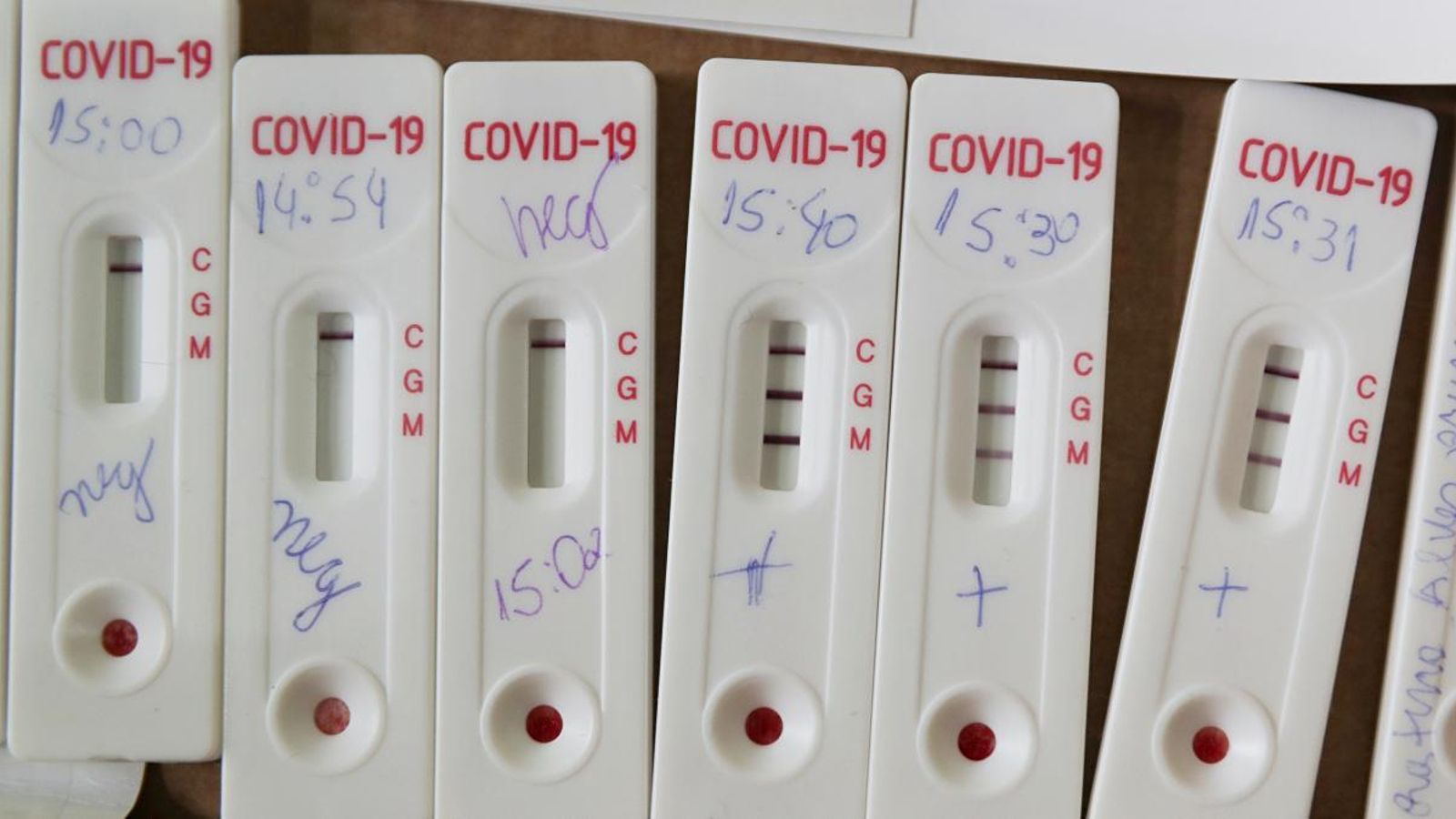 Proves de Covid-19 realitzades al Brasil