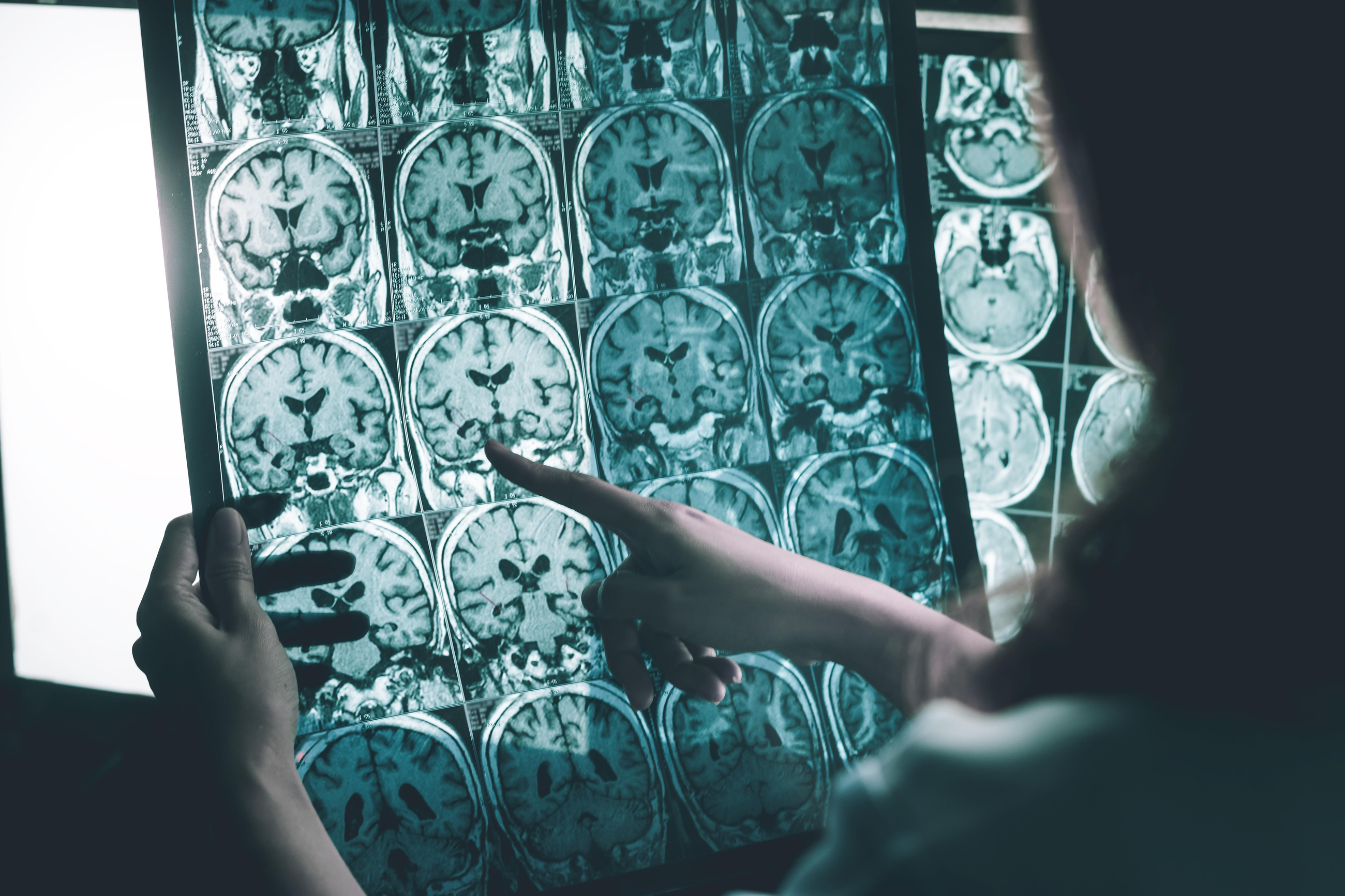 Una facultativa examina una radiografia del cervell