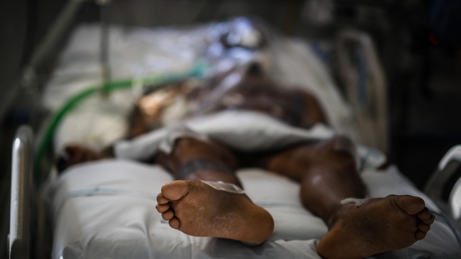 Paciente con coronavirus en una hospital argentino en una imagen de archivo