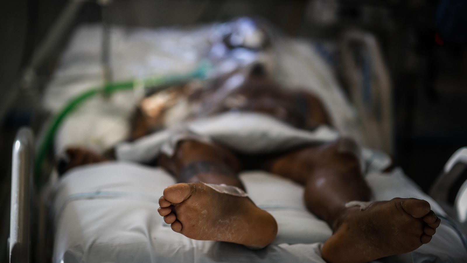 Pacient amb coronavirus en un hospital argentí en una imatge d'arxiu Paciente con coronavirus en una hospital argentino en una imagen de archivo