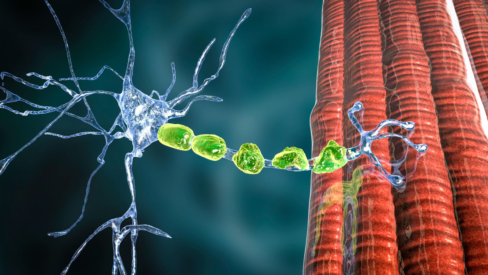 Neurona afectada per la malaltia de Charcot-Marie-Tooth