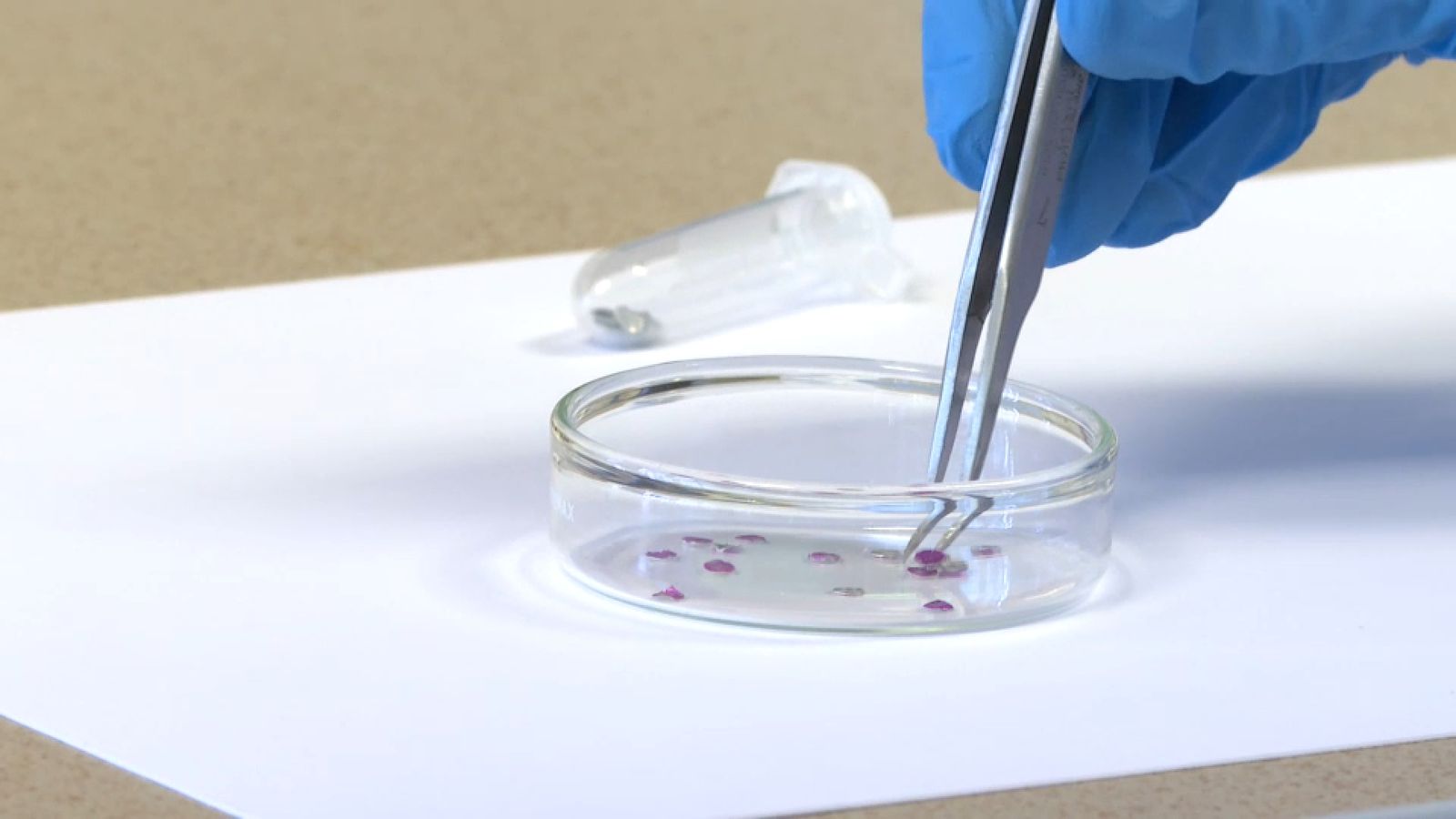 El biosensor suposa un avanç significatiu en el diagnòstic precoç del càncer de mama