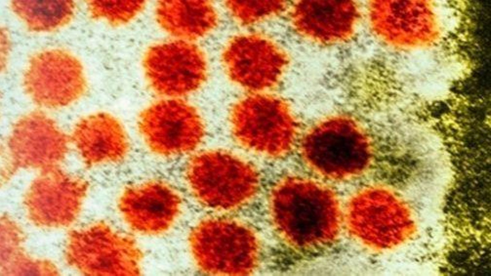 Visió microscòpica de l'hepatitis A