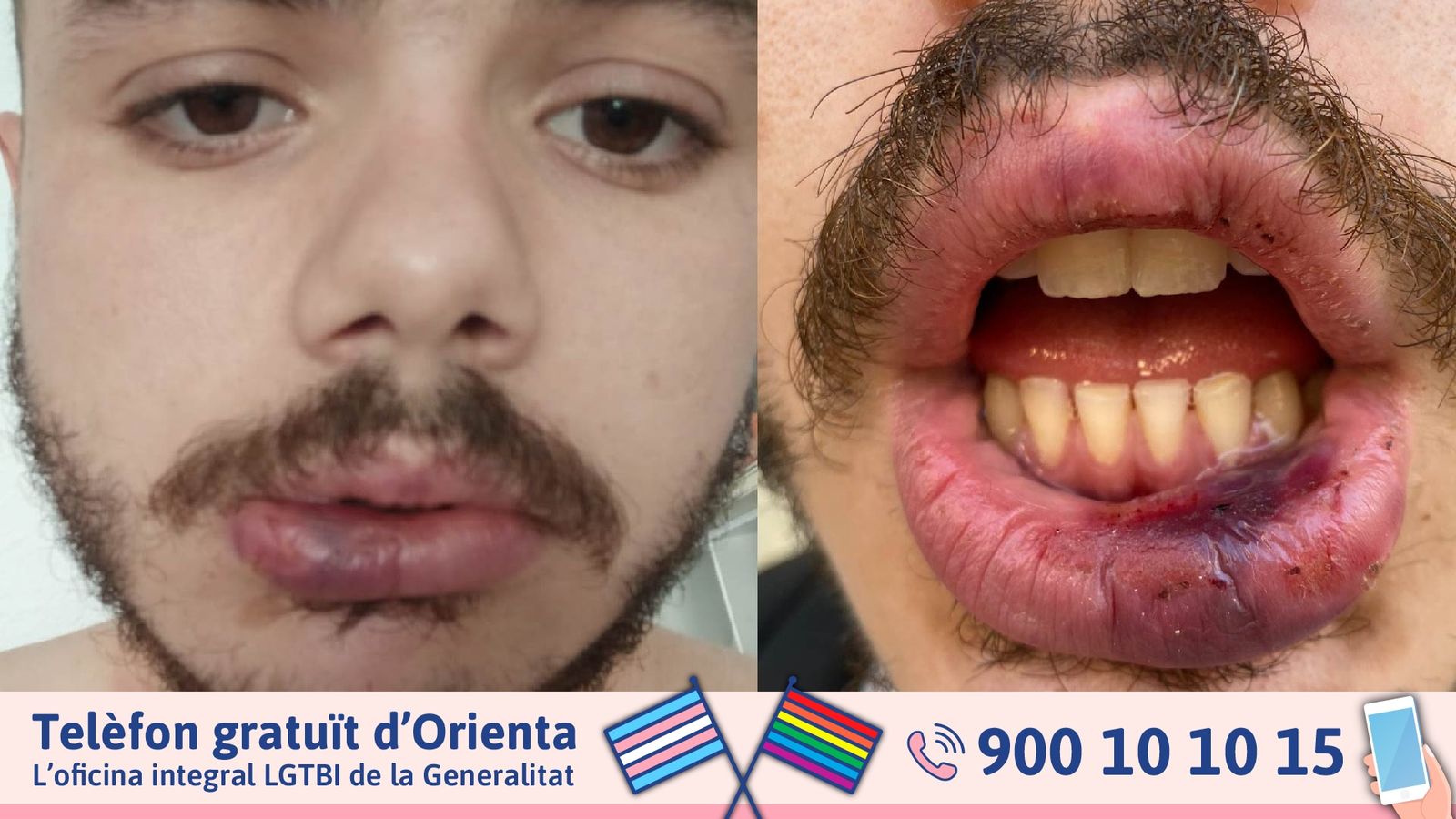 Denuncien agressió homòfoba València