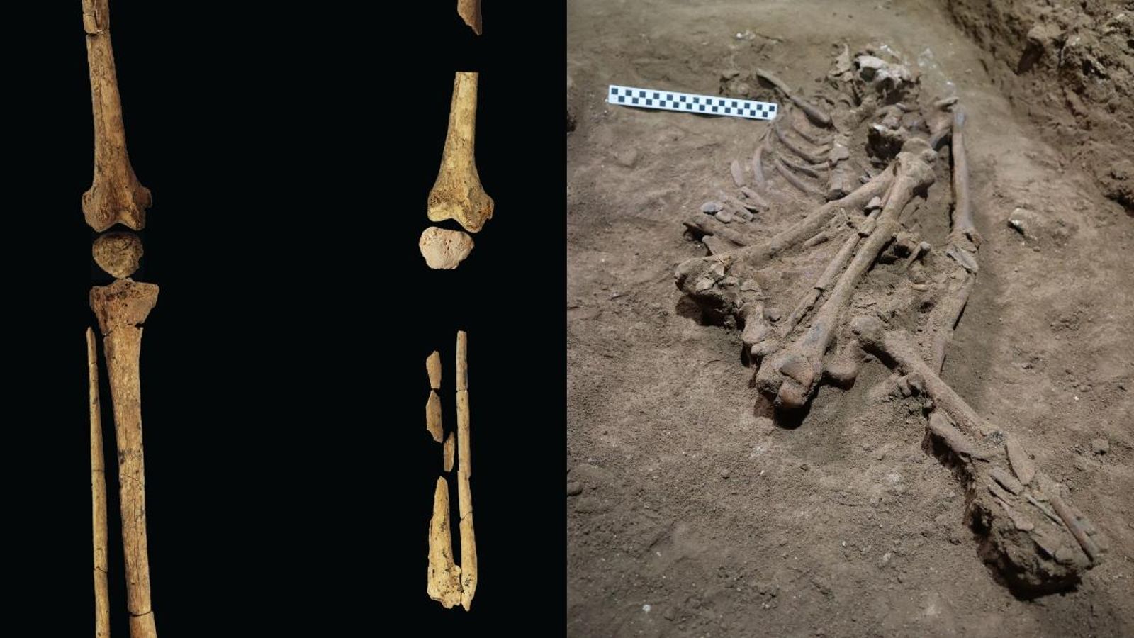 D'esquerra a dreta, detall de la cama amputada i l'esquelet trobat a l'excavació D'esquerra a dreta, detall de la cama amputada i l'esquelet trobat en l'excavació