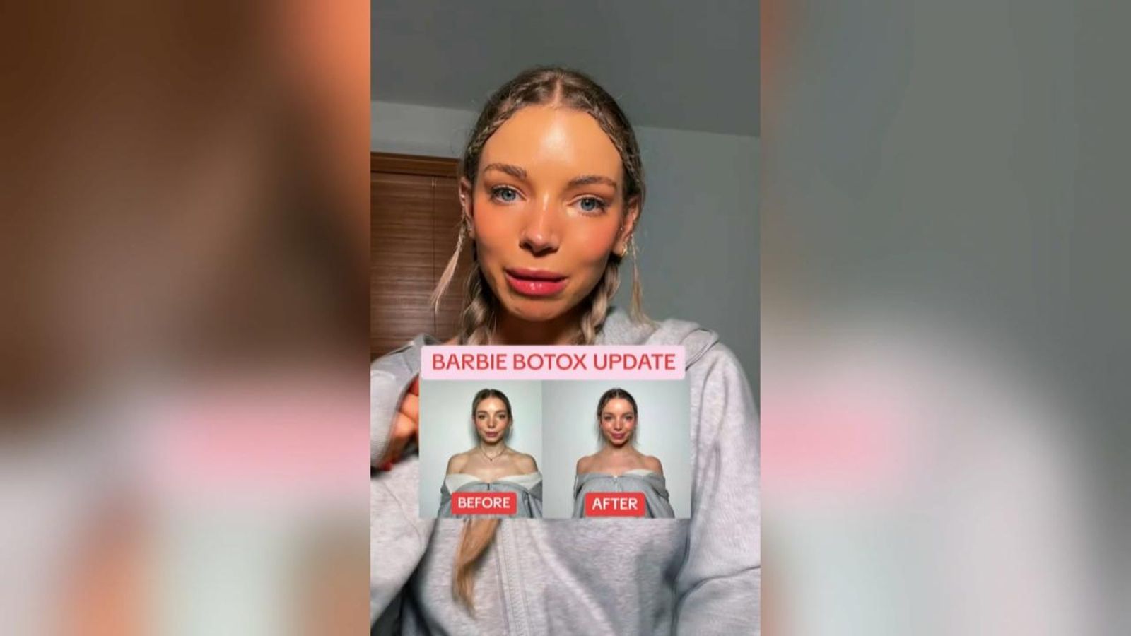 La perillosa pràctica del Barbie bòtox