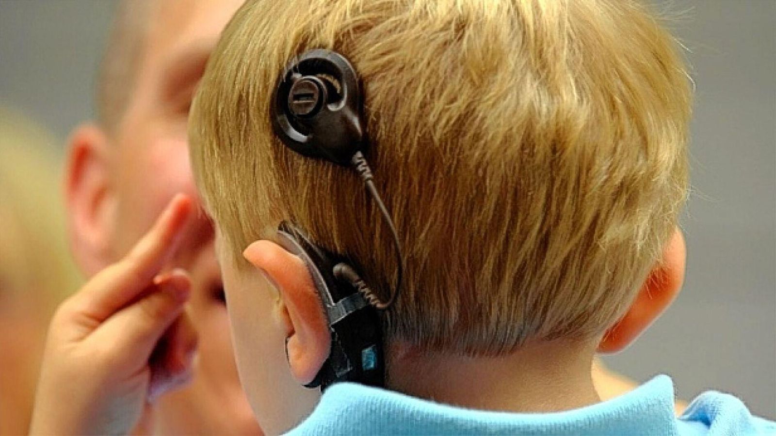 L'implant coclear és l'única opció per a sentir que tenen molts pacients amb problemes auditius