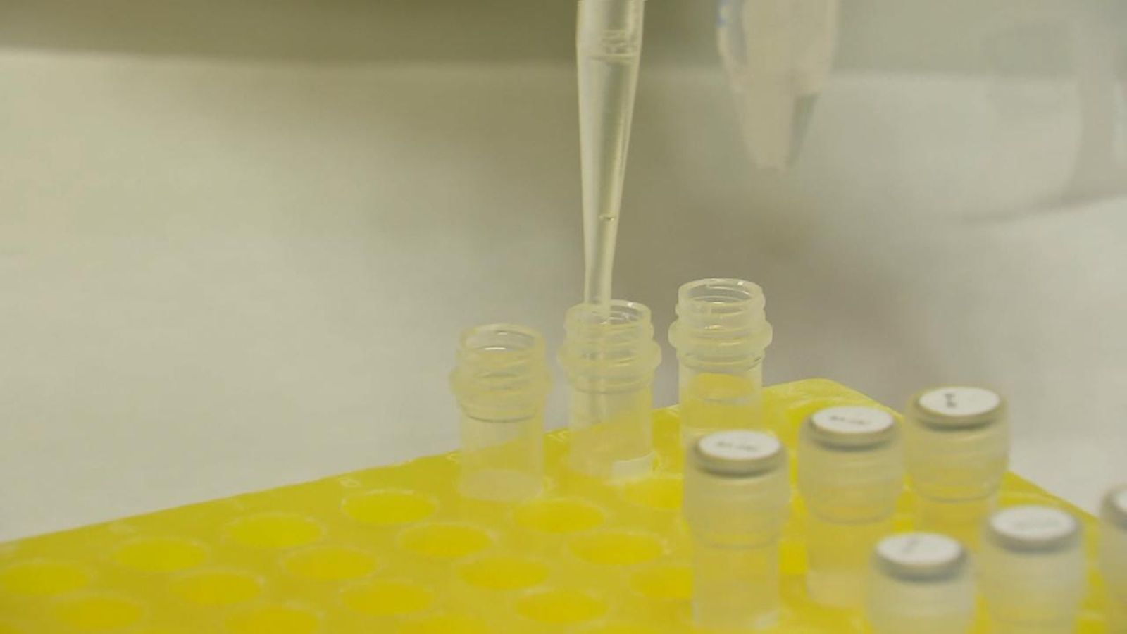 La detecció precoç en fonamental per curar-se de la malaltia