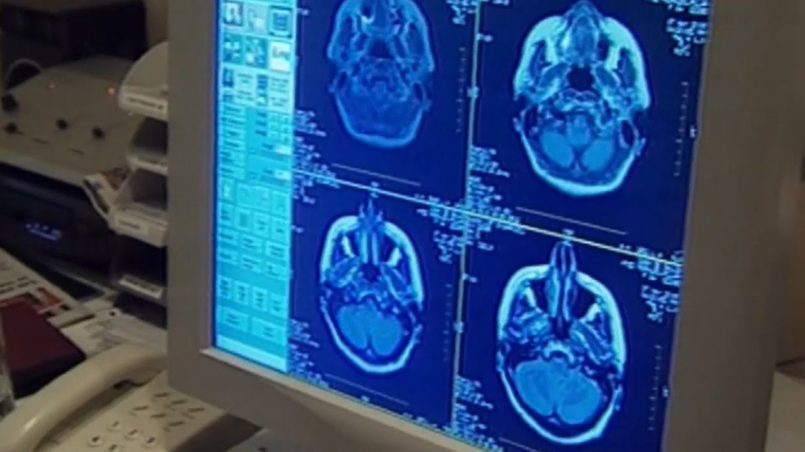 Cada any se'n diagnostiquen a tot Espanya uns 40.000 casos nous