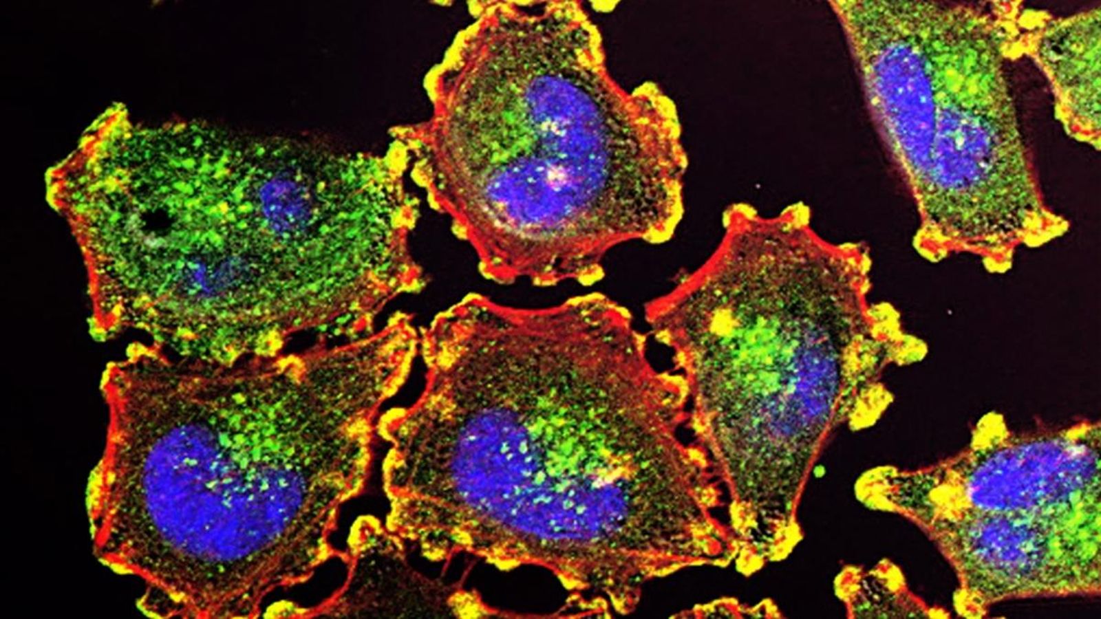 Fes clic per a escoltar la valoració sobre les implicacions del macro estudi que ha fet a 'Les Noticíes del Migdia' el cap d'Oncologia de l'Hospital Clínic de València, Andrés Cervantes