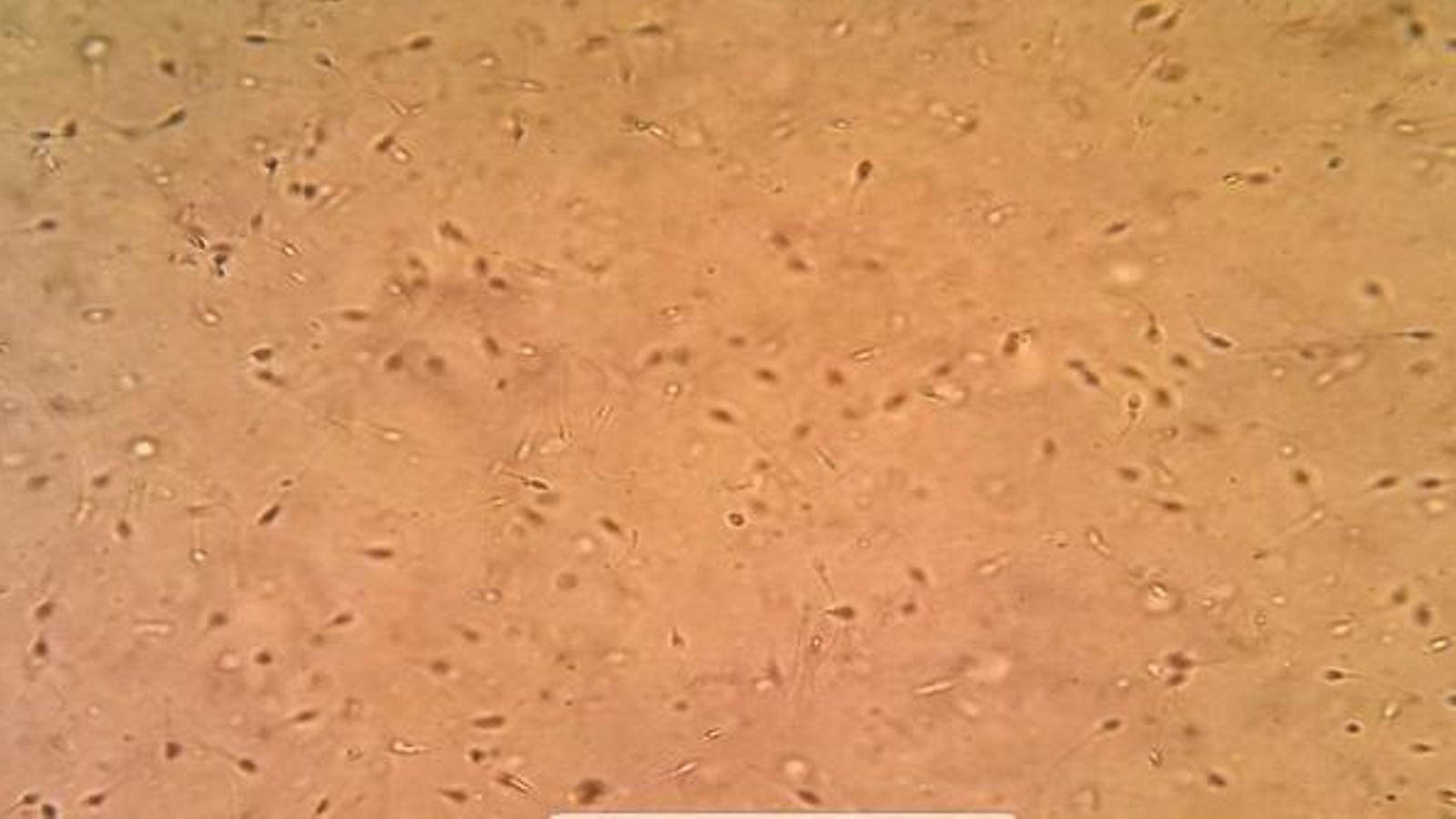 Vista microscòpica d'uns espermatozoides